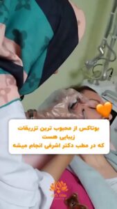 نمونه کار تزریق بوتاکس (کلینیک زیبایی سی گل)