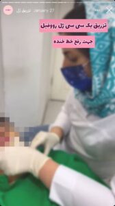 نمونه کار تزریق ژل دکتر الهه اندخشیده در مشهد
