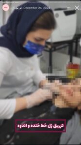 نمونه کار تزریق ژل دکتر الهه اندخشیده در مشهد