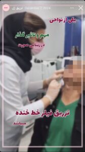 نمونه کار تزریق ژل دکتر الهه اندخشیده در مشهد