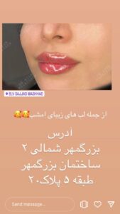 نمونه کار تزریق ژل (دکتر اعظم خانزاده)