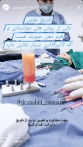 نمونه کار تزریق چربی دکتر مهدی رزم آرا در مشهد