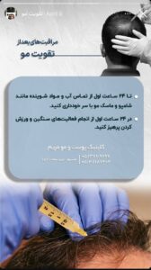 نمونه کار درمان ریزش مو