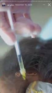 نمونه کار