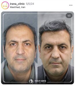 نمونه کار