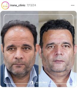 نمونه کار