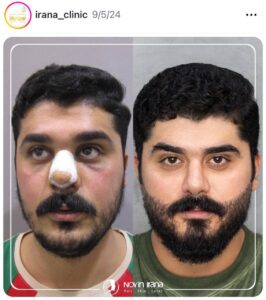 نمونه کار
