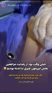 نمونه کار لیزر مو های زائد کلینیک شاپرک در مشهد