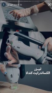 لیزر موهای زائد کلینیک مریم در مشهد