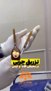 نمونه تزریق چربی (کلینیک سی گل)
