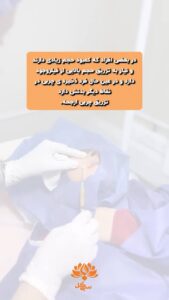 نمونه تزریق چربی (کلینیک سی گل)