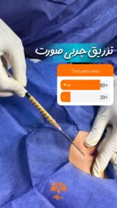 نمونه تزریق چربی (کلینیک سی گل)