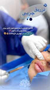 نمونه تزریق چربی (کلینیک سی گل)