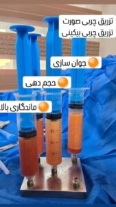 نمونه تزریق چربی (کلینیک دنیز)