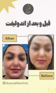 نمونه کار