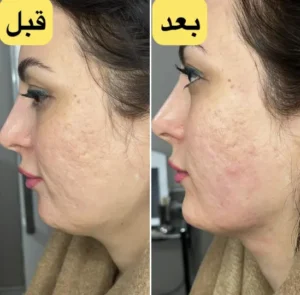 نمونه کار