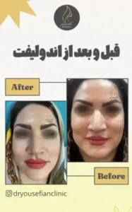 نمونه کار