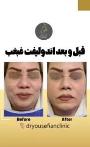 نمونه کار