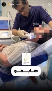 نمونه کار رفع غبغب دکتر یوسفیان در مشهد