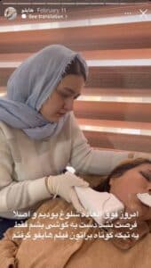 نمونه کار رفع غبغب دکتر فرشته طاهر در مشهد