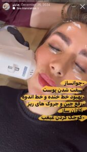 نمونه کار رفع غبغب دکتر فرشته طاهر در مشهد