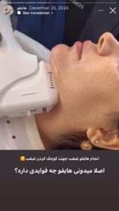 نمونه کار رفع غبغب دکتر فرشته طاهر در مشهد
