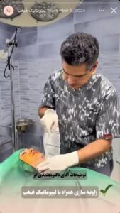 نمونه کار رفع غبغب دکتر جلال معتمدی فر در مشهد