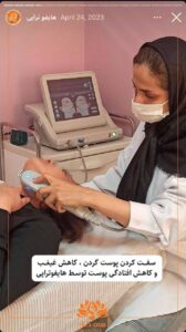 نمونه کار رفع غبغب کلینیک سی گل