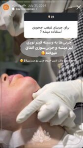 نمونه کار رفع غبغب کلینیک سی گل