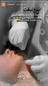 نمونه کار رفع غبغب کلینیک سی گل