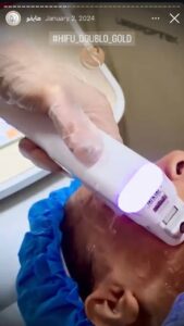 نمونه کار رفع غبغب کلینیک سلامت ایده آل در مشهد