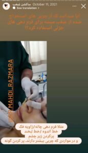 نمونه کار رفع غبغب دکتر مهدی رزم آرا در مشهد