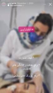 نمونه کار رفع غبغب دکتر الهه اندخشیده در مشهد