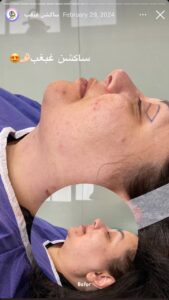 نمونه کار رفع غبغب دکتر نعیمه ارگنجی