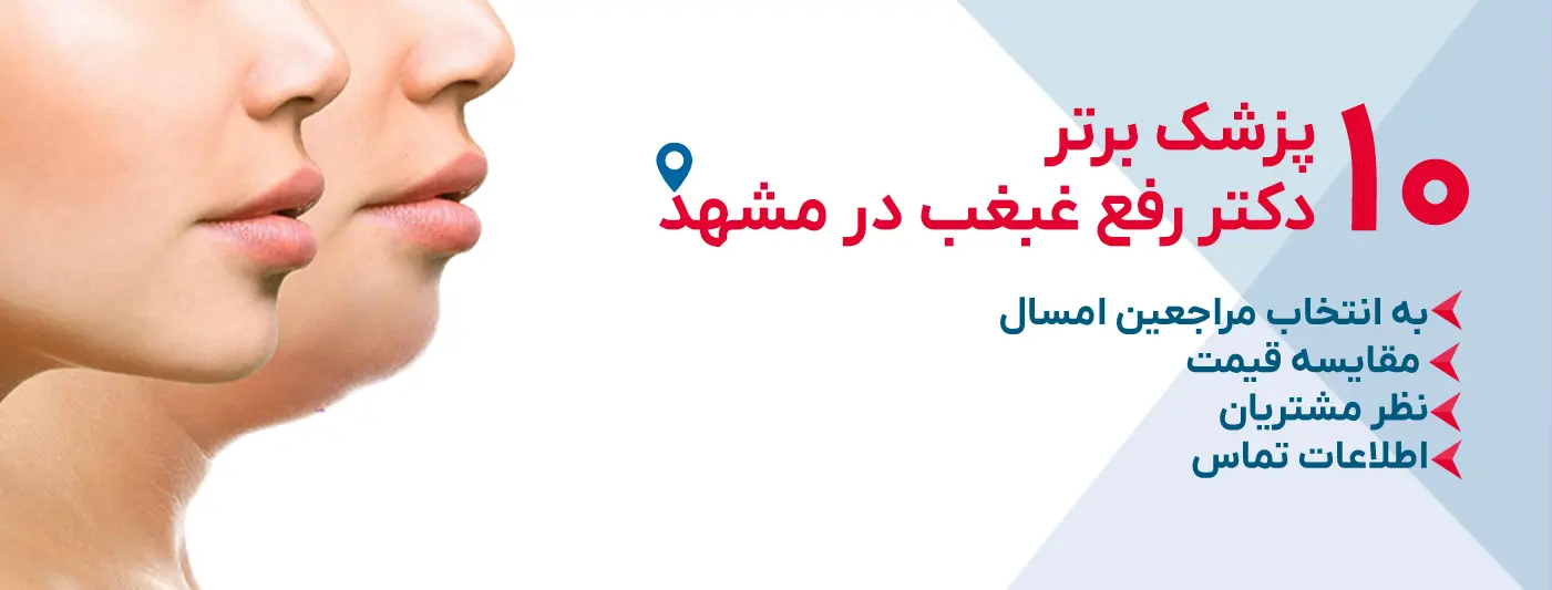 بهترین دکتر رفع غبغب در مشهد