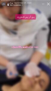 نمونه کار پی آر پی دکتر الهه اندخشیده در مشهد