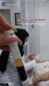 نمونه کار پی آر پی دکتر الهه اندخشیده در مشهد