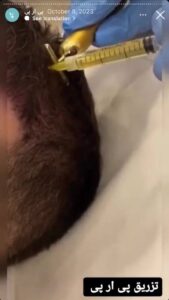 نمونه کار پی آر پی دکتر الهه مولوی در مشهد