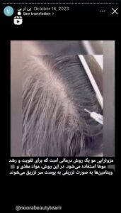 نمونه کار پی آر پی دکتر الهه مولوی در مشهد