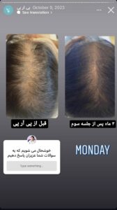 نمونه کار پی آر پی دکتر الهه مولوی در مشهد