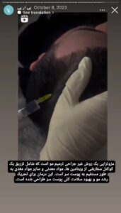 نمونه کار پی آر پی دکتر الهه مولوی در مشهد