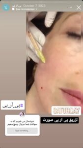 نمونه کار پی آر پی دکتر الهه مولوی در مشهد