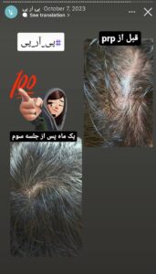 نمونه کار پی آر پی دکتر الهه مولوی در مشهد