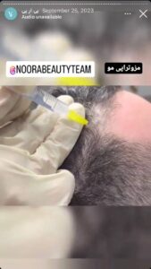 نمونه کار پی آر پی دکتر الهه مولوی در مشهد