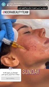 نمونه کار پی آر پی دکتر الهه مولوی در مشهد