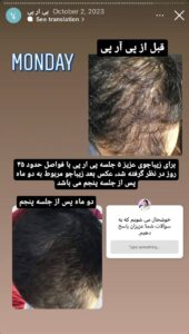 نمونه کار پی آر پی دکتر الهه مولوی در مشهد