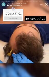 نمونه کار پی آر پی دکتر الهه مولوی در مشهد
