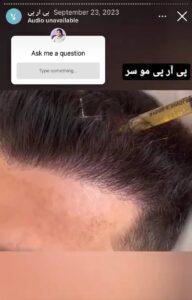 نمونه کار پی آر پی دکتر الهه مولوی در مشهد