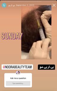 نمونه کار پی آر پی دکتر الهه مولوی در مشهد