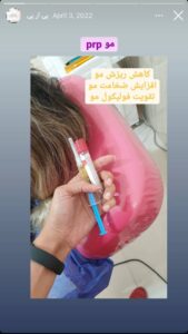 نمونه کار پی آر پی دکتر مرضیه پیش گوی در مشهد